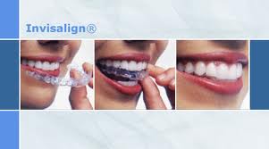 Invisalign braces Melbourne cheap