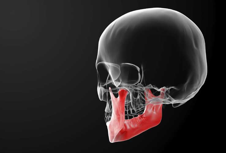 best orthodontic jaw surgery melbourne