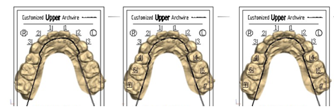 best lingual orthodontist