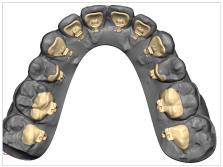 suresmile melbourne